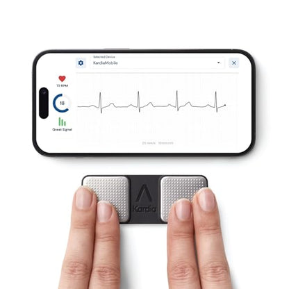 Recording of ECG using KardiaMobile, a portable personal ECG device that connects to smartphones for easy heart rhythm monitoring.